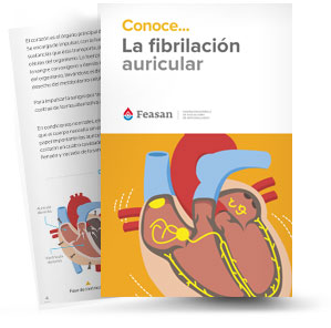 la fibrilacion articular